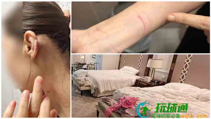 无业汉1小时内先在酒店房奸劫女赌友  再扮换钱党殴劫两女终落网